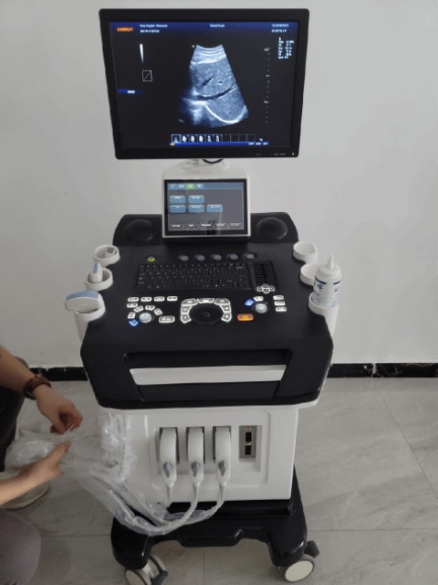 Ultrasound setup