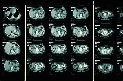 Advanced imaging setup