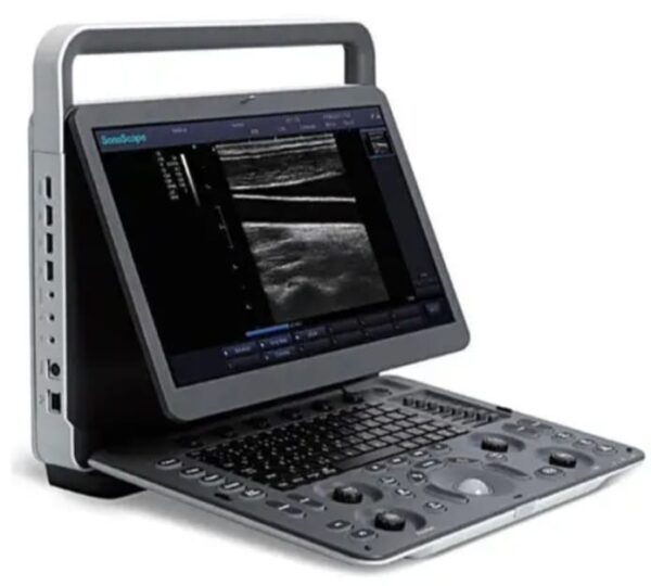 Portable Doppler Ultrasound System - Image 5
