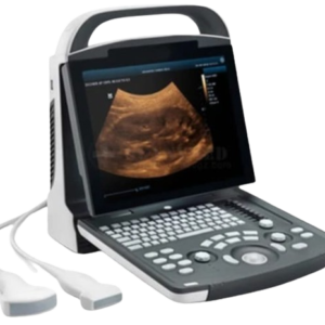Portable Doppler Ultrasound System