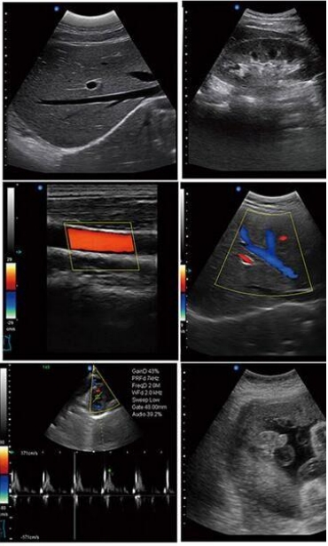 3D COLOR DOPPLER ULTRASOUND - Image 7